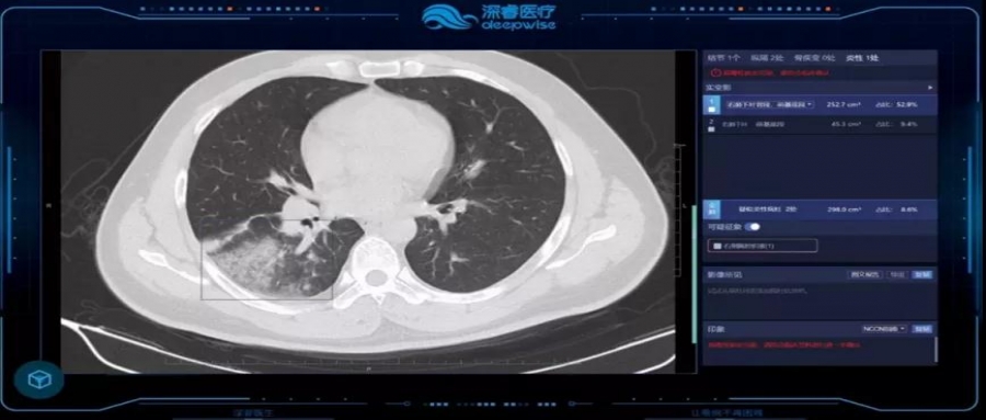 以高效运算建设影像数据中心，助力AI精准诊疗、医疗资料互联共享